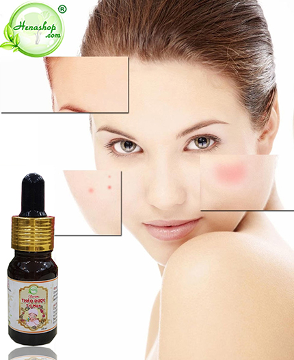 serum thảo dược trị mụn henashop.com